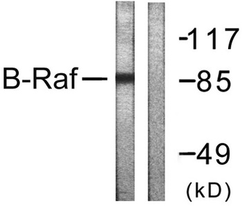 Raf-B antibody