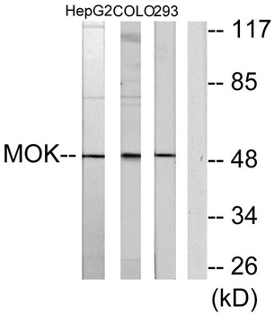 RAGE antibody