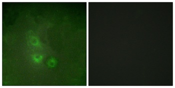 Rak antibody