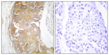 Rak antibody