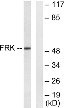 Rak antibody