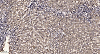 Ran BP-6 antibody