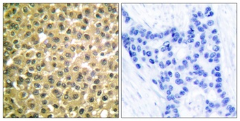 RAR beta antibody