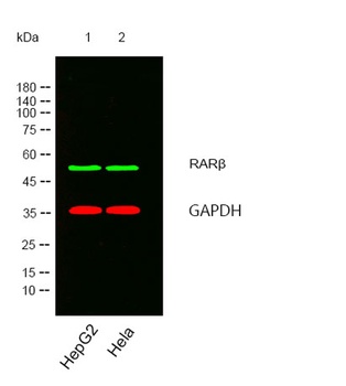 RAR beta antibody