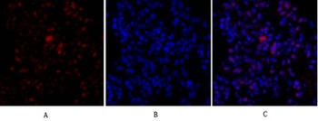 Rb antibody