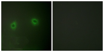 Renin Receptor rabbit pAb
