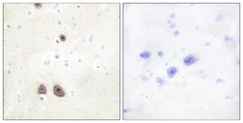 Renin Receptor rabbit pAb