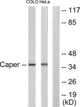 Renin Receptor rabbit pAb