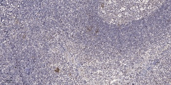 Repo-Man antibody