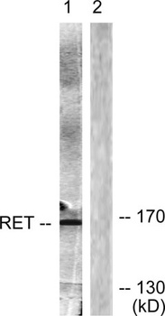 Ret antibody