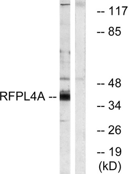RFPL4A rabbit pAb