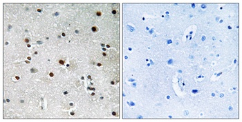 RFX3 antibody