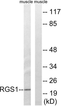 RGS1 rabbit pAb