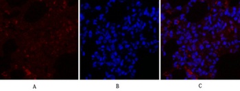 Rho A antibody