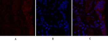 Rho A antibody