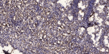 Rho D antibody