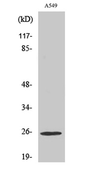 Rho GDIγ rabbit pAb