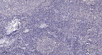 RhoBTB1/2 rabbit pAb