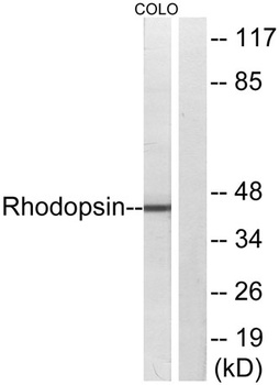 Rhodopsin antibody