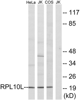Ribosomal Protein L10L antibody