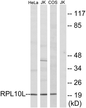 Ribosomal Protein L10L rabbit pAb