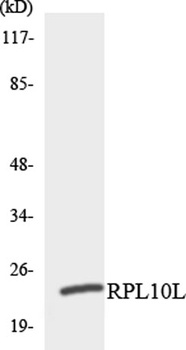 Ribosomal Protein L10L rabbit pAb
