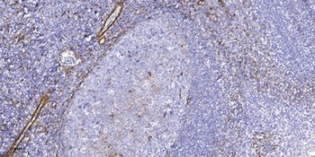 Ribosomal Protein L10L rabbit pAb