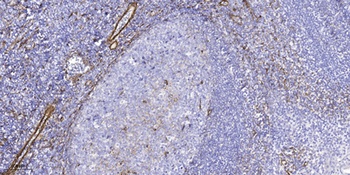 Ribosomal Protein L10L antibody