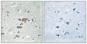 Ribosomal Protein L12 antibody