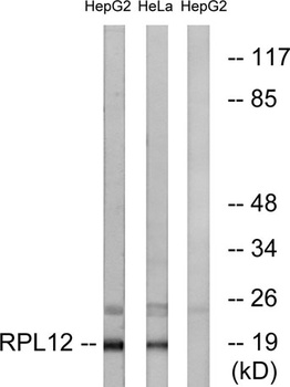 Ribosomal Protein L12 rabbit pAb
