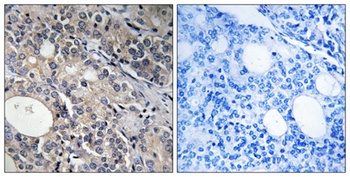 Ribosomal Protein L17 rabbit pAb
