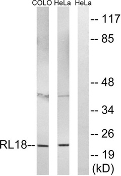 Ribosomal Protein L18 rabbit pAb