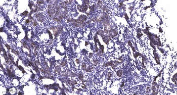Ribosomal Protein L18 antibody