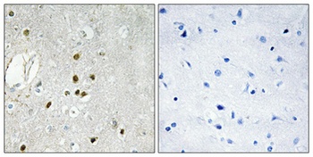 Ribosomal Protein L27A antibody