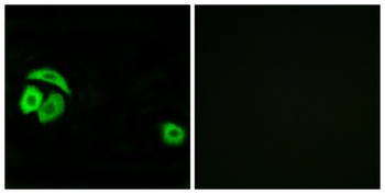 Ribosomal Protein L27A antibody