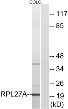 Ribosomal Protein L27A antibody