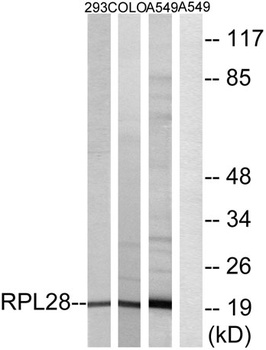 Ribosomal Protein L28 rabbit pAb
