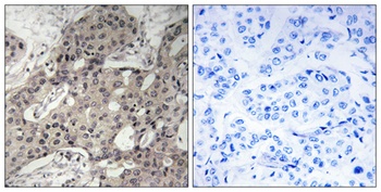 Ribosomal Protein L3 rabbit pAb