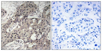 Ribosomal Protein L3 antibody