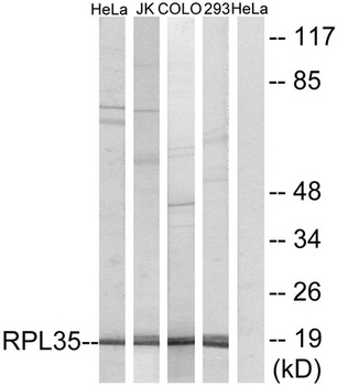 Ribosomal Protein L35 rabbit pAb