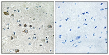 Ribosomal Protein S12 rabbit pAb