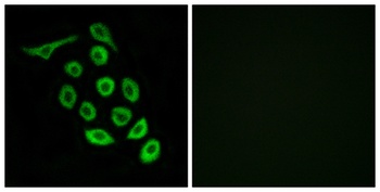 Ribosomal Protein S12 rabbit pAb
