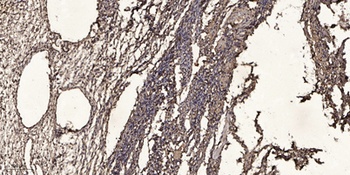 Ribosomal Protein S2 rabbit pAb