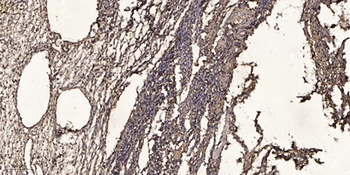 Ribosomal Protein S2 antibody