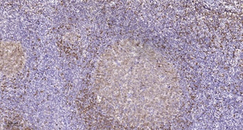 Ribosomal Protein S27L antibody