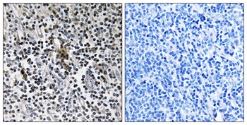 Ribosomal Protein S3 antibody