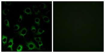 Ribosomal Protein S4X antibody