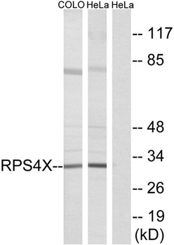 Ribosomal Protein S4X rabbit pAb