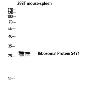 Ribosomal Protein S4Y1 rabbit pAb