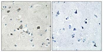 Ribosomal Protein S4Y1 rabbit pAb